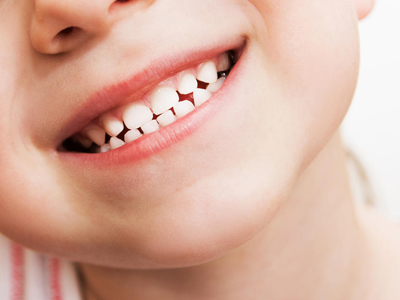 What Can I Do to Decrease My Child’s Chances of Getting Cavities?