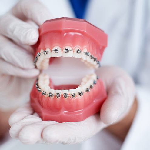 a dentist holding a model of a mouth with braces