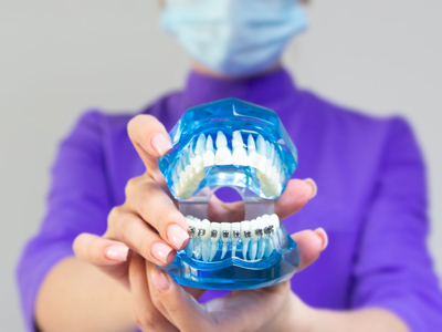 5 Tips to Care Your Kids Braces | Orthodontics El Paso