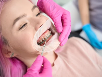 How to Prepare for Orthodontics in El Paso Treatment