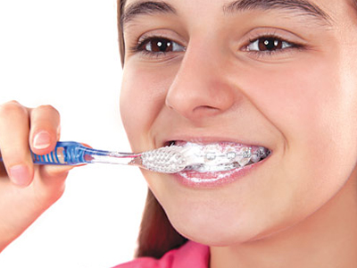 Caring For Braces